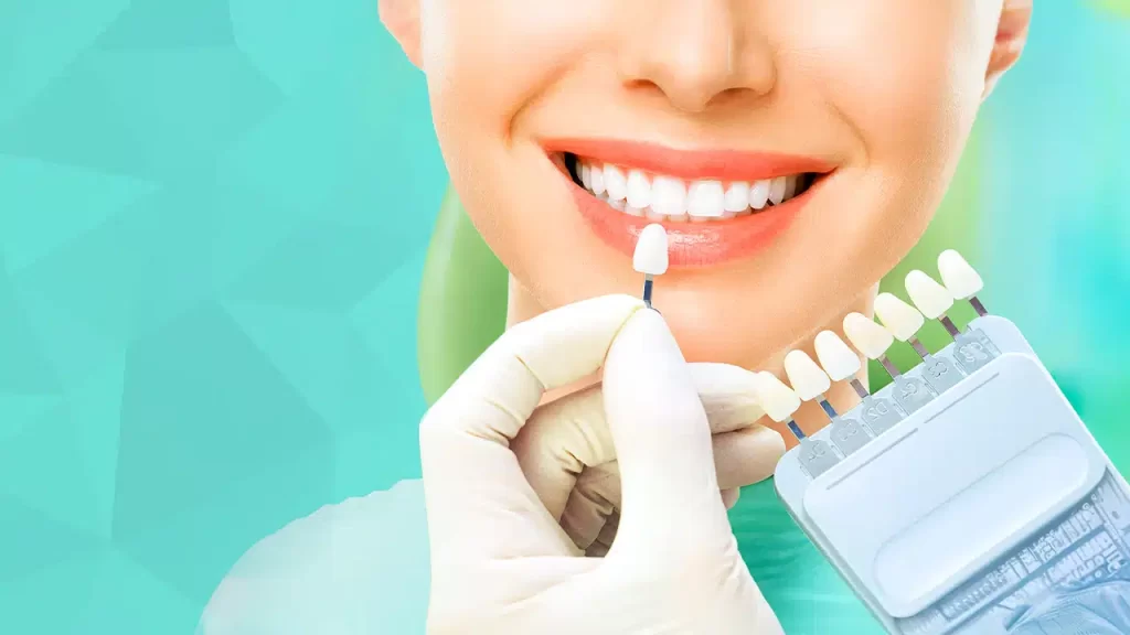 Diferenca_entre_lentes_de_contato_dental_e_facetas_dentais